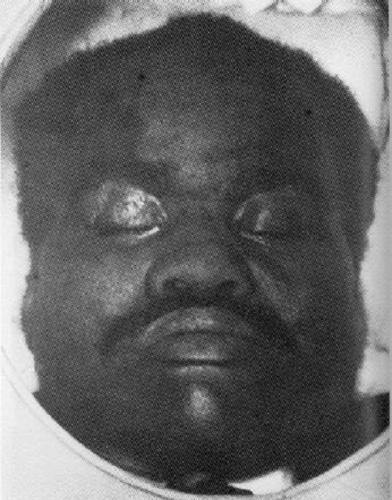 Marcus Garvey in death. He once stopped crowds on the streets of American cities with his oratory and his his Back to Africa movement in the 1920s. He died alone and impoverished in a London slum.